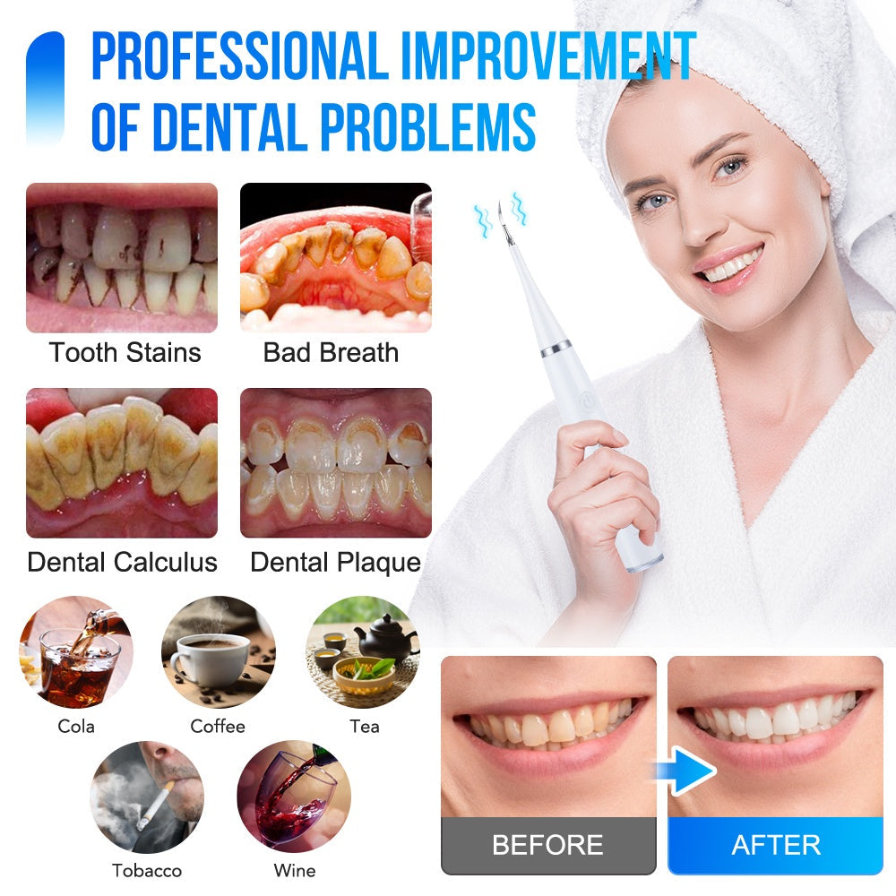 SonicBright™ Ultrasonic Dental Cleaner